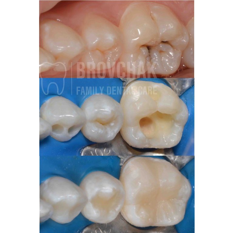 3 кадрів вертикально