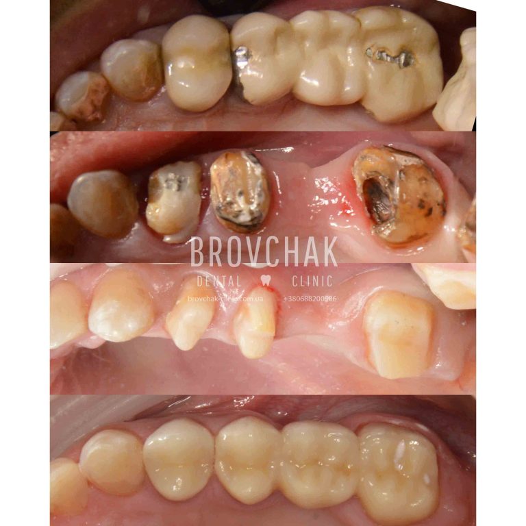 верх права сторон1а