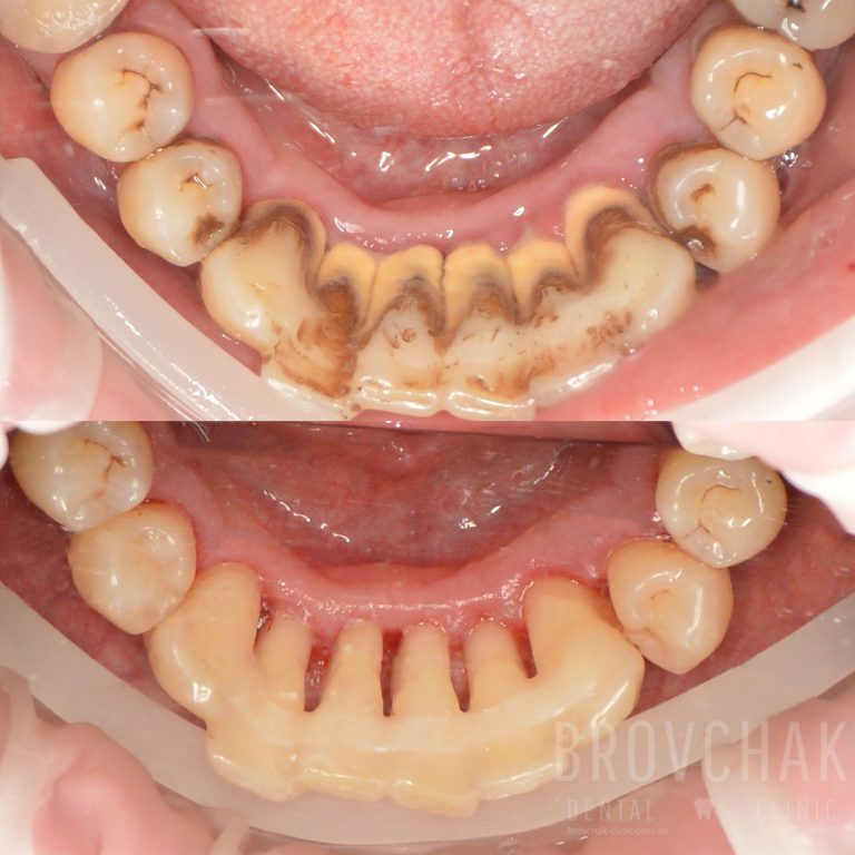 ????????????????????????????????????