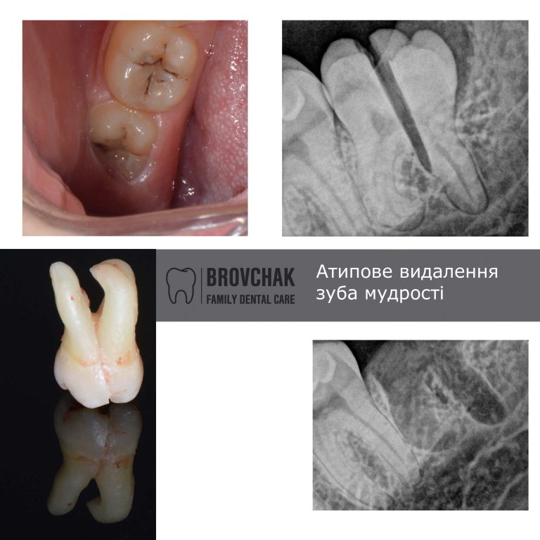 Без имени-11